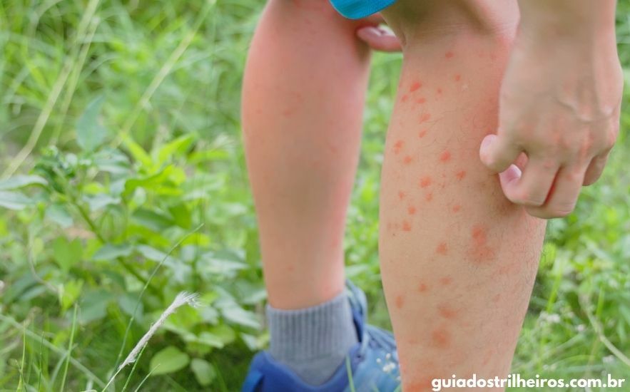 o que passar em picada de borrachudo